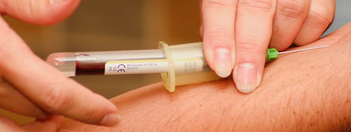 Fresenius Medical Care trifft die Erwartungen