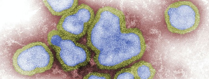 Was macht der Coronavirus aus dem kanadischen Dollar? - Newsbeitrag